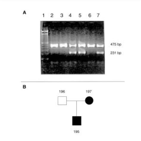 Sex Determination Gel And Sample Mix Up Pedigree A Lane 1 100 Bp Download Scientific