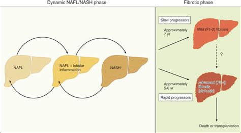 Epidemiology Natural History And Evaluation Of Nonalcoholic Fatty