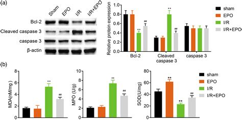 Erythropoietin Alleviates Acute Lung Injury Induced By Ischemia