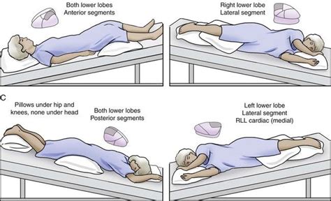 Pin By Daigo On Equal Pressure Point Theory Gate Pictures Airway Clearance Pressure Points