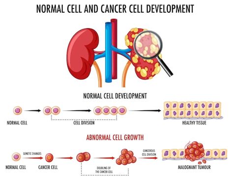 Diagrama que muestra células normales y cancerosas Vector Gratis