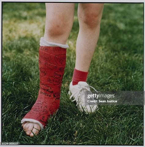 429 Child In Leg Cast Stock Photos High Res Pictures And Images