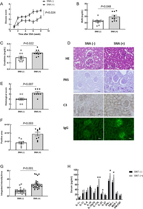 Skeletal Muscle Loss Accelerates Nephritis Progression In Lupusprone