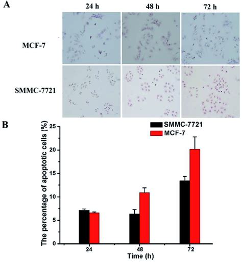 The Apoptosis Of MCF 7 And SMMC 7721 Cells Was Evaluated By TUNEL