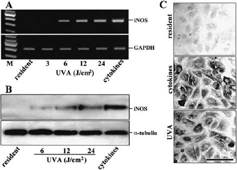 Uva 1 Irradiation Induces Nos 2 Mrna And Protein Expression In Hudec