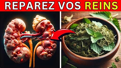 Les Meilleures Plantes Pour D Toxiquer Et Nettoyer Vos Reins