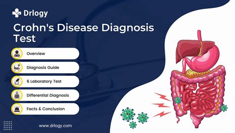 Easy And Effective Tests For Crohn S Disease Diagnosis Drlogy