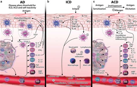 Immune Mechanism In The Pathogenesis Of Atopic Dermatitis AD