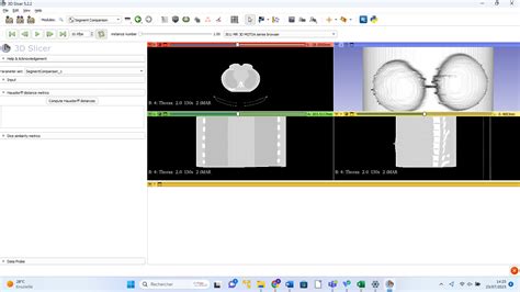 Dice Dicoms Image Support 3d Slicer Community