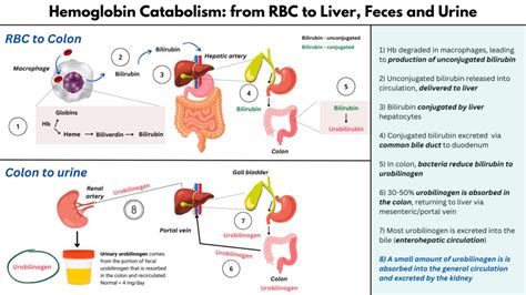 Urobilinogen in Hemolytic Anemia • The Blood Project