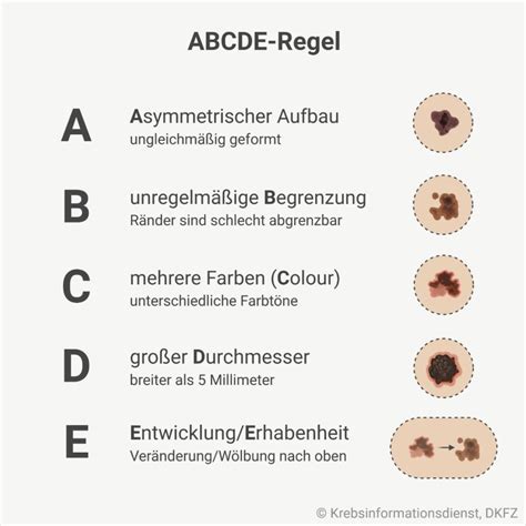 Hautkrebsscreening Und Hautkrebs Fr Herkennung