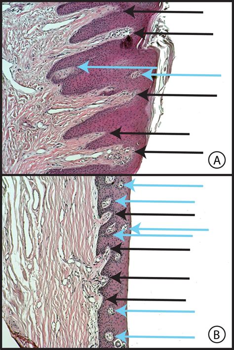 Hard Palate Histology