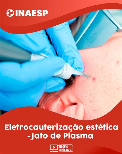 Curso Eletrocauterização Estética Jato de Plasma Instituto Nacional