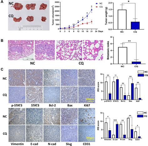 Chloroquine Suppresses Proliferation And Invasion And Induces Apoptosis