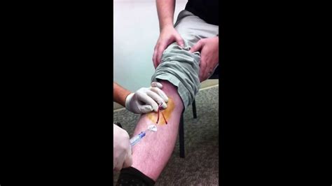 Intraosseous Demonstration - YouTube