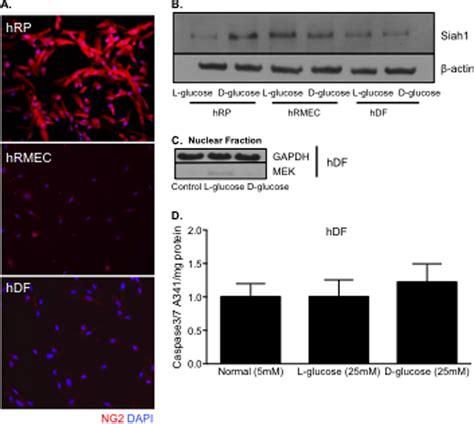 Gapdh Siah Complex In Hrp Human Retinal Microvascular Endothelial