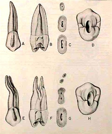 Morfología 2 premolar superior