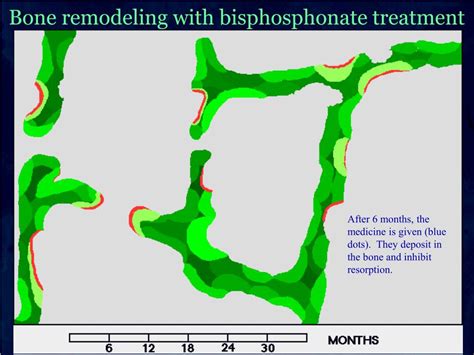 PPT - Bone remodeling animations PowerPoint Presentation, free download - ID:475101