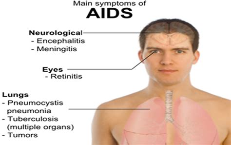 Common Myths About HIV and AIDS