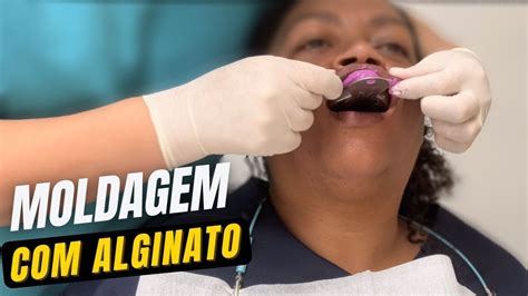 Como Moldar Alginato Hydrogum Moldagem Odontol Gica How To Take