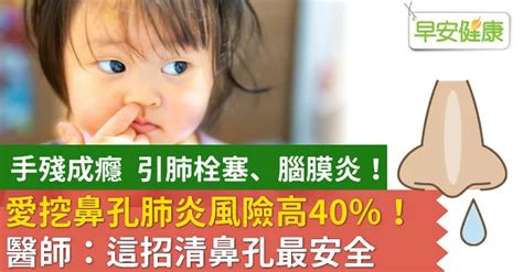 愛挖鼻孔肺炎風險高40％！醫師：這招清鼻孔最安全 ＊ 阿波羅新聞網