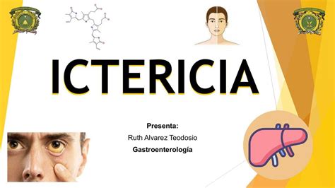 Ictericia Ra L Bastida Navarrete Udocz