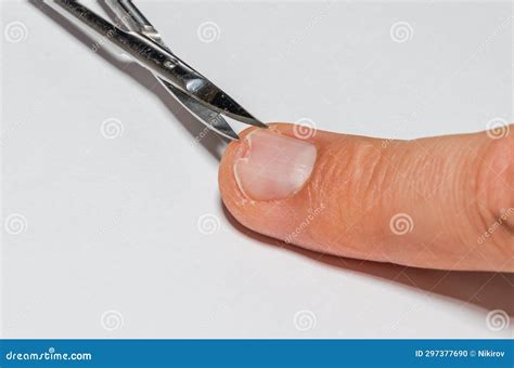 First Aid for a Patient with a Broken Fingernail Stock Photo - Image of ...