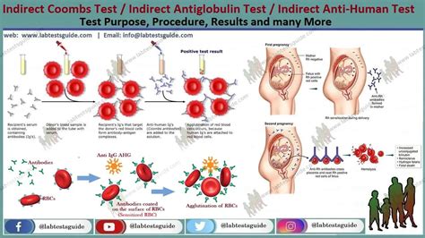 Coombs Test Principle Types Procedure And Result Off