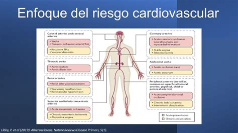 Riesgo Cardiovascular Un Enfoque Endocrino Desde Las Dislipidemias Ldl Alto Hdl Bajo