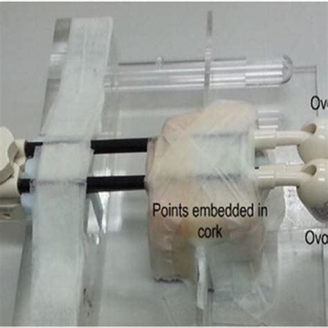 Experimental phantom for cervix brachytherapy applicator including... | Download Scientific Diagram