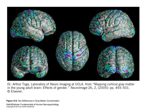 Variations In Cerebral Asymmetry Ppt Download