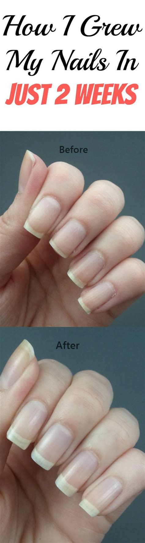 Amazing Tips And Tricks To Grow Your Nails Fast How To Grow Nails