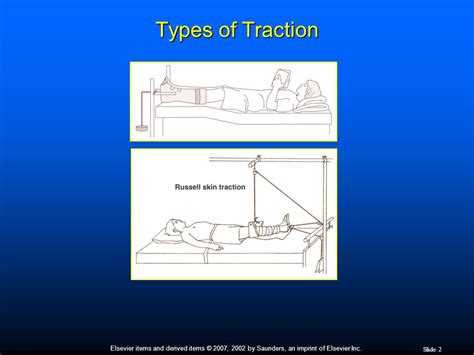 what type of traction is bryant's traction - Wiring Work