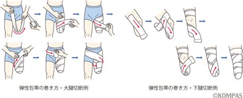 切断のリハビリテーション｜kompas