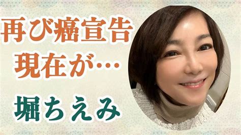 堀ちえみ 病気でベロを6割以上切除！？2度目の癌宣告で現在の姿がヤバいと話題に！？