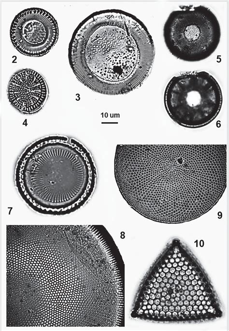 Marine Benthic Diatoms In The Coral Reefs Off Basra Fig 2 Cyclotella