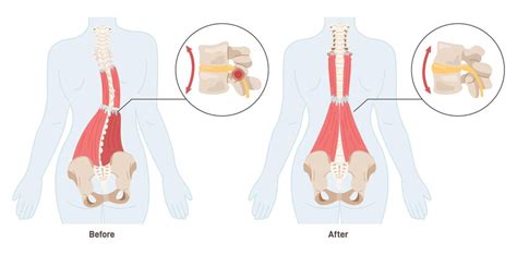 Premium Vector | Massage effect back pain treatment and muscles ...