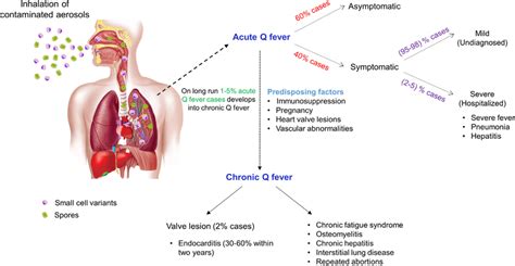 Clinical Characteristics Developmental Stages Of Q Fever In Humans