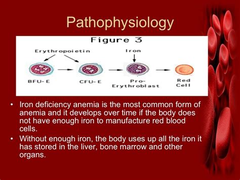 Iron deficiency anemia.