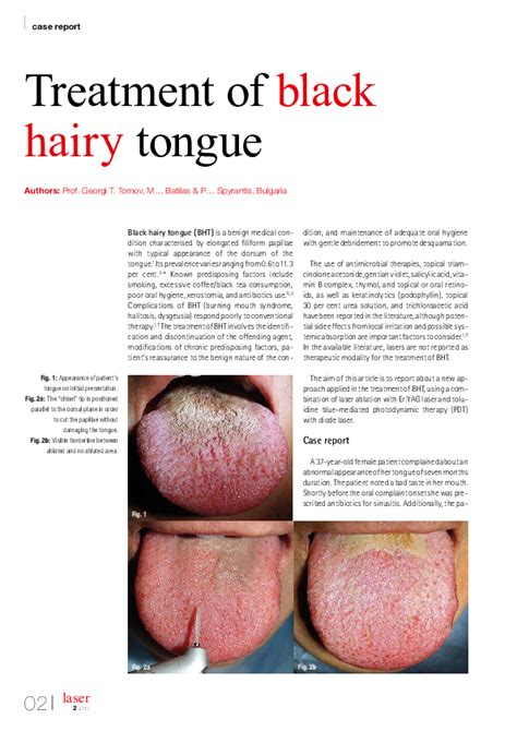 (PDF) Treatment of black hairy tongue | Георги Томов - Academia.edu