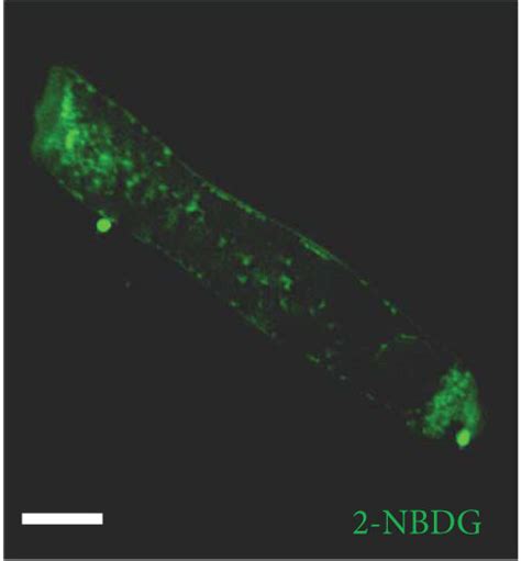 Uptake Of Nbdg Into Ohcs And Concentration Or Time Dependent Uptake