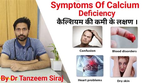 Calcium Deficiency Symptomsकैल्शियम की कमी के लक्षण कारणrole Of Calcium In Human Bodycalcium