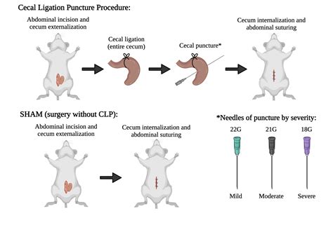 Cecal Ligation Puncture Procedure Biorender Science Templates