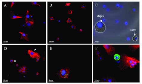 Morphology of the three main types of hemocytes in fifth instar P. napi... | Download Scientific ...