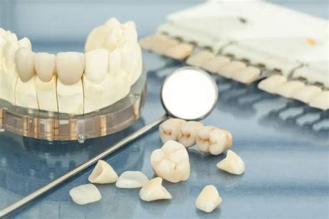 Dental Crown Procedure Step By Step Guide Sedation Dentistry Located