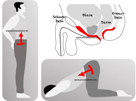 Beckenbodentraining für den Mann Wie und warum