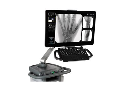 Orthoscan TAU 1515 The Mini C Arm Ziehm Imaging EN