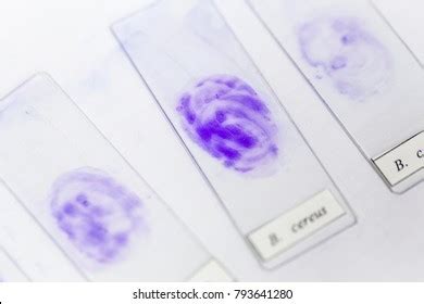 Technique Smear Preparation Microbiology Education Lab Stock Photo