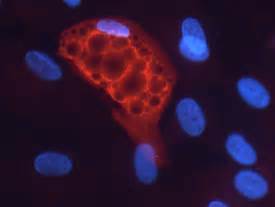 Human Adiponutrin Pnpla Antibody Af R D Systems