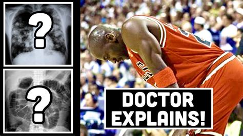 Doctor Explains Michael Jordan Flu Game 1997 Nba Finals Game 5